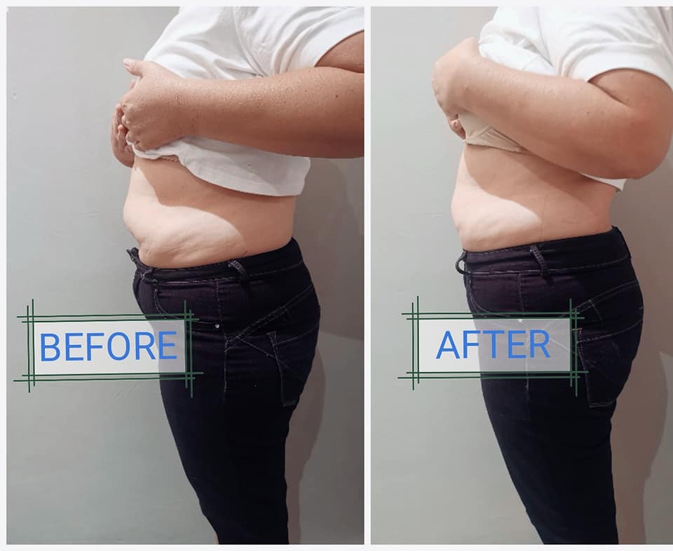 weight loss