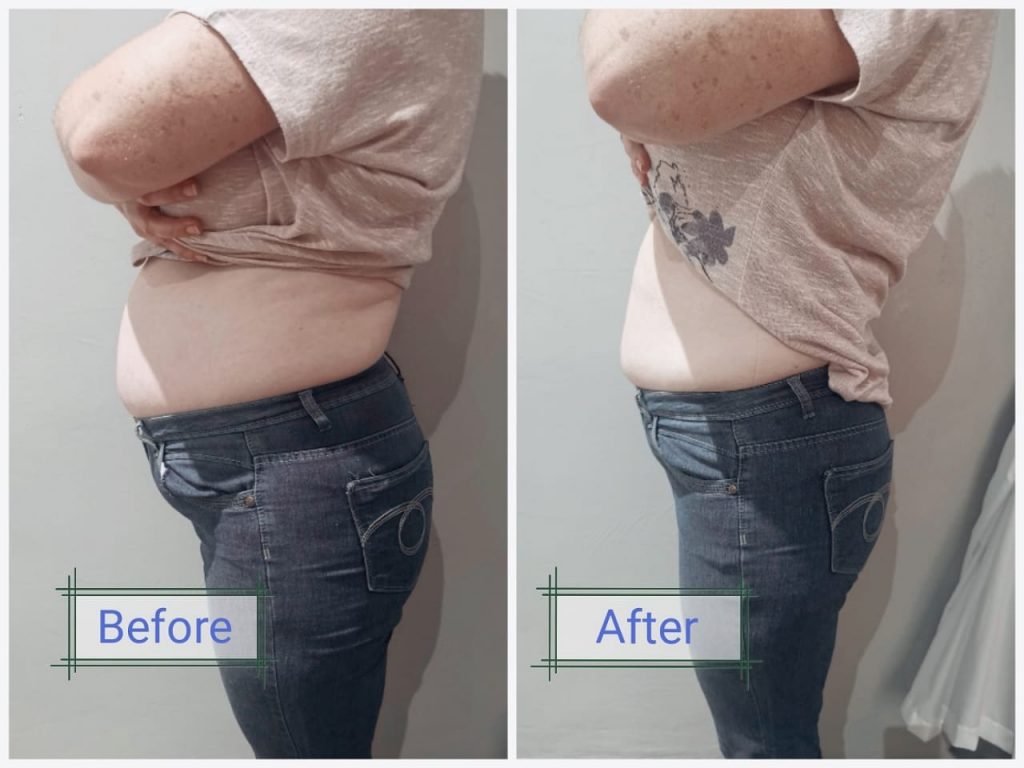 weight Loss