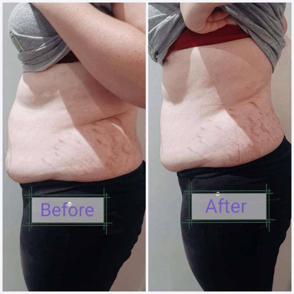 weight Loss