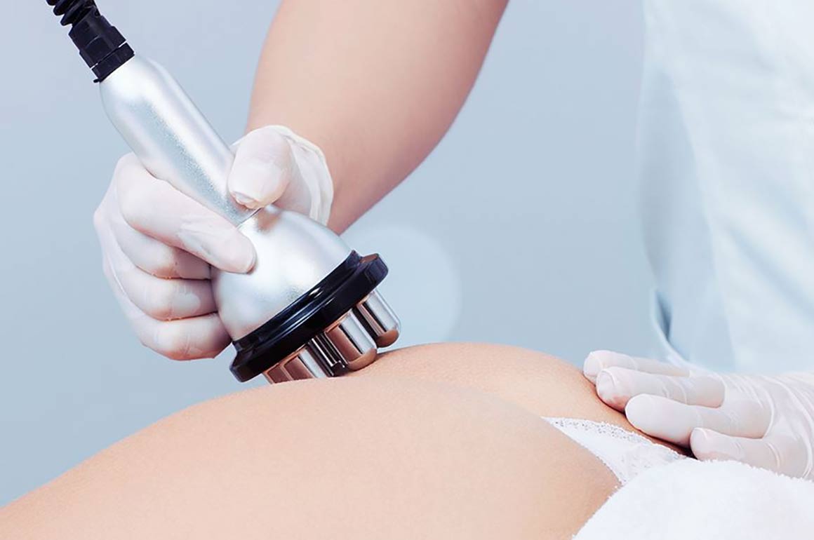 Radio Frequency Treatment Radio Frequency Skin Tightening