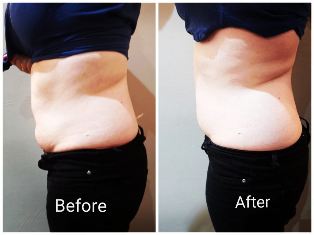 weight Loss