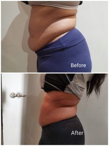 weight Loss